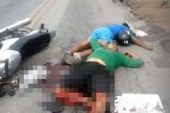 バイク事故で膝から下が切断されかけている男性