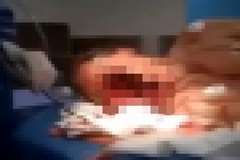 自殺に失敗し?顔が完全に破壊されるもまだ息がある男性