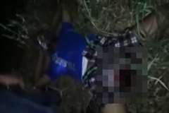 バイク事故で大事な部分を失ってしまった男性