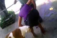 激しい出血・・・ピットブルに襲われる女性