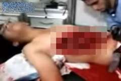 呼吸する度に動く臓器・・・腹部が大きく裂けている男性が病院で処置を受けている映像